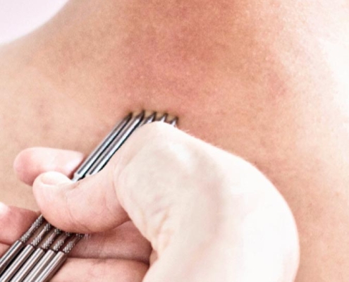 Klawiterapia - Naturopata.com.pl