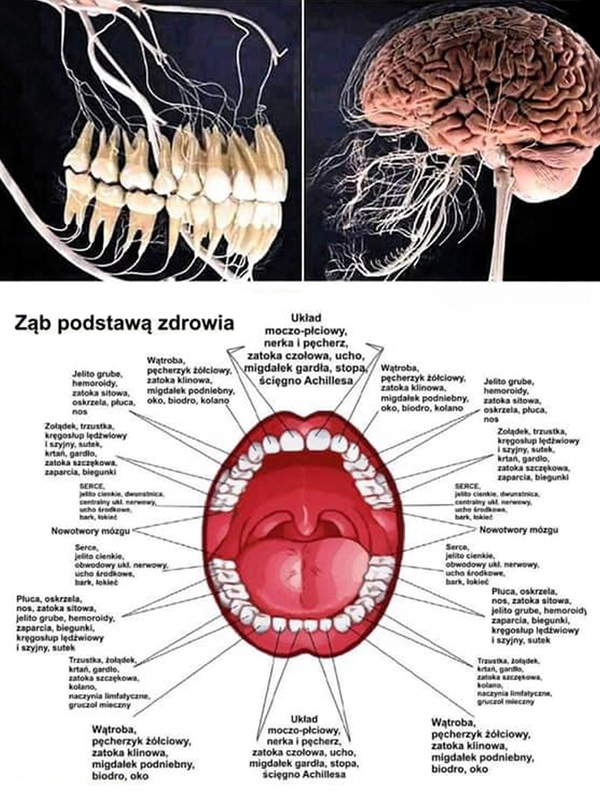 Kanałowe leczenie zębów - Naturopata.com.pl